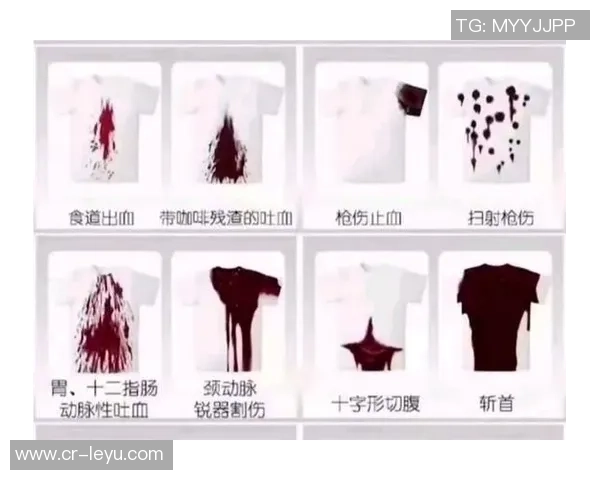 米利唐首次体检未能通过初步判断伤势情况较轻 米利唐首次体检未能通过初步判断伤势情况较轻